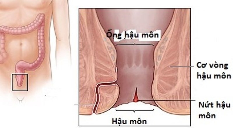 bị trĩ lâu ngày có sao không