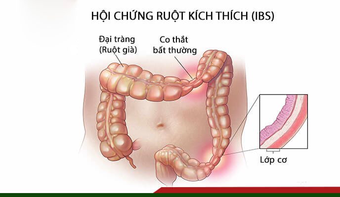 không đi vệ sinh nặng nhiều ngày