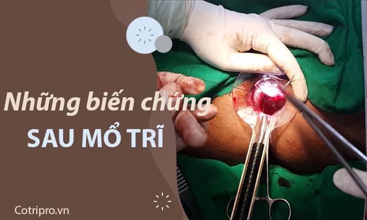 Mổ trĩ có nguy hiểm không? 10+ Biến chứng sau mổ trĩ