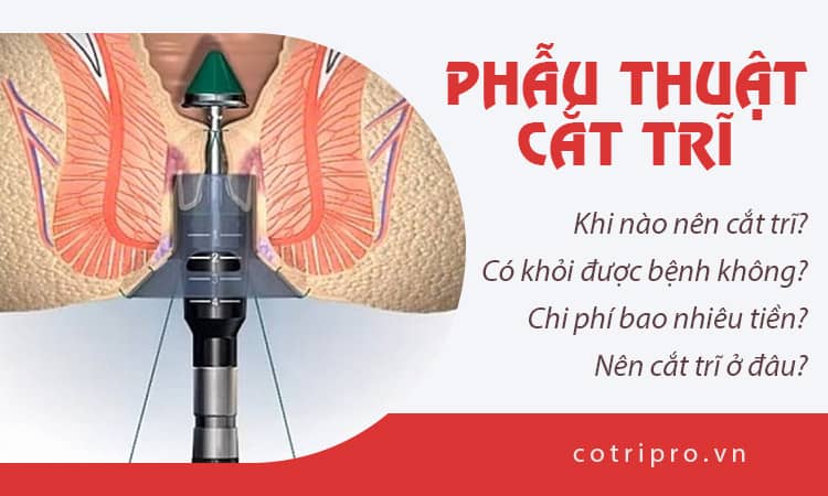 Cắt mổ trĩ hết bao nhiêu tiền? Nên cắt mổ trĩ ở đâu tốt?