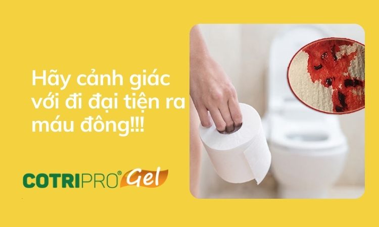 Đi ngoài ra máu đông (máu cục) Nguyên nhân cách điều trị