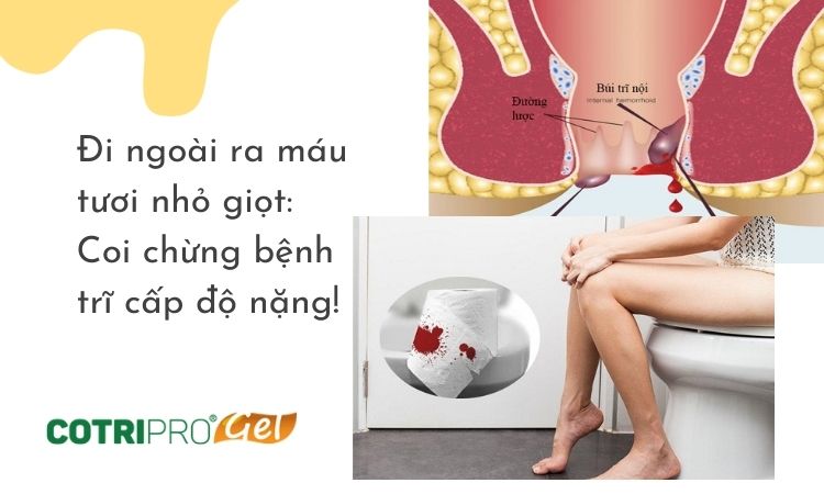 Đi ngoài ra máu tươi nhỏ giọt: nguyên nhân, điều trị thế nào