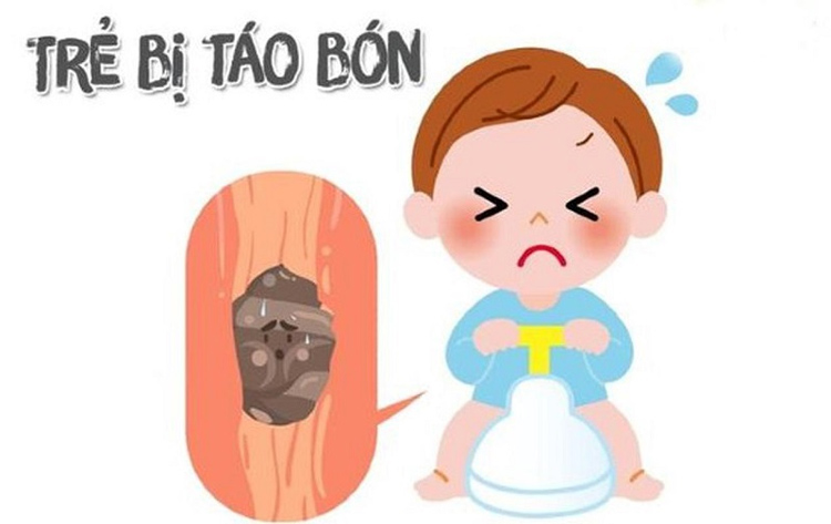 Nguyên nhân bị bệnh trĩ ở trẻ em