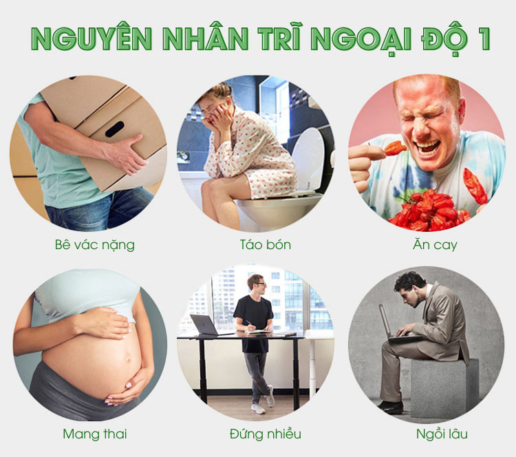 Nguyên nhân trĩ ngoại độ 1