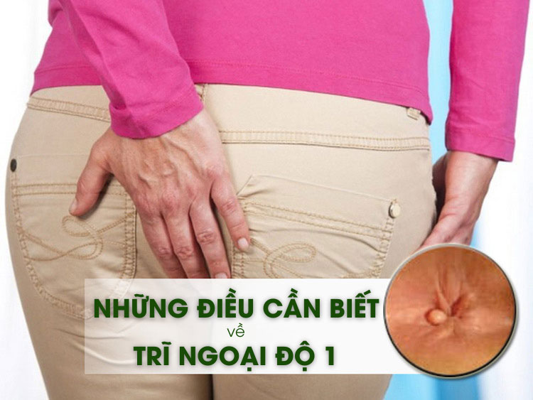 Trĩ ngoại độ 1 | Nguyên nhân, triệu chứng và cách điều trị