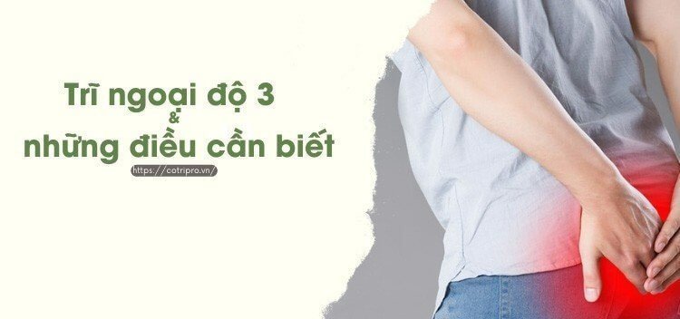 Trĩ Ngoại Độ 3 là gì? Triệu chứng, điều trị như thế nào?