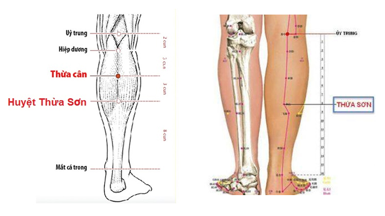 Bấm huyệt chữa bệnh trĩ