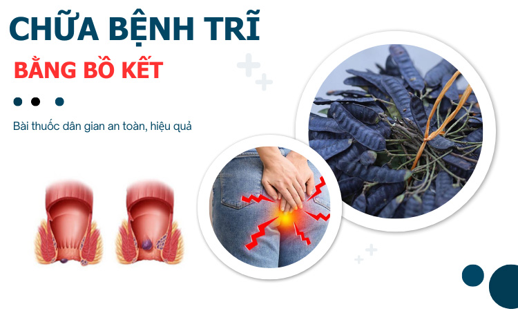 #4 Bài thuốc chữa bệnh trĩ bằng bồ kết hiệu quả tại nhà