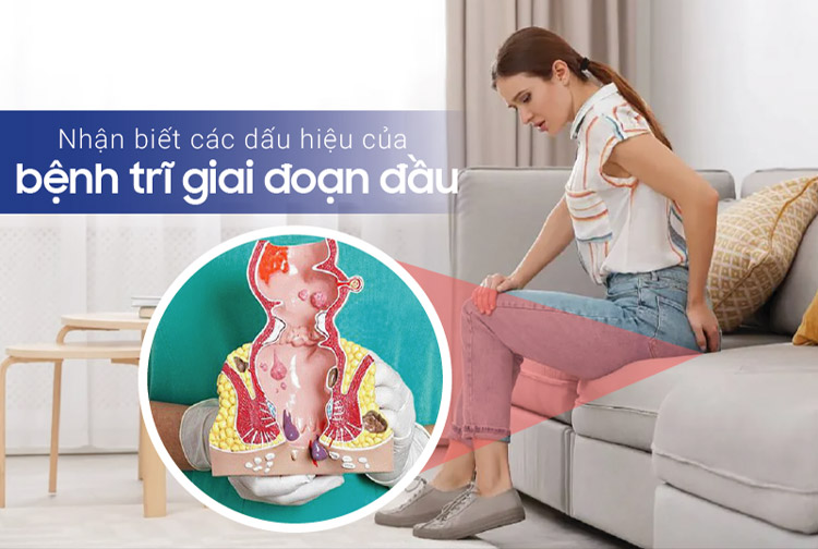 Bệnh trĩ có gây đau lưng không