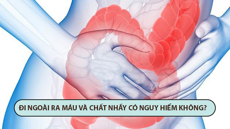 đi ngoài ra máu và chất nhầy có nguy hiểm không