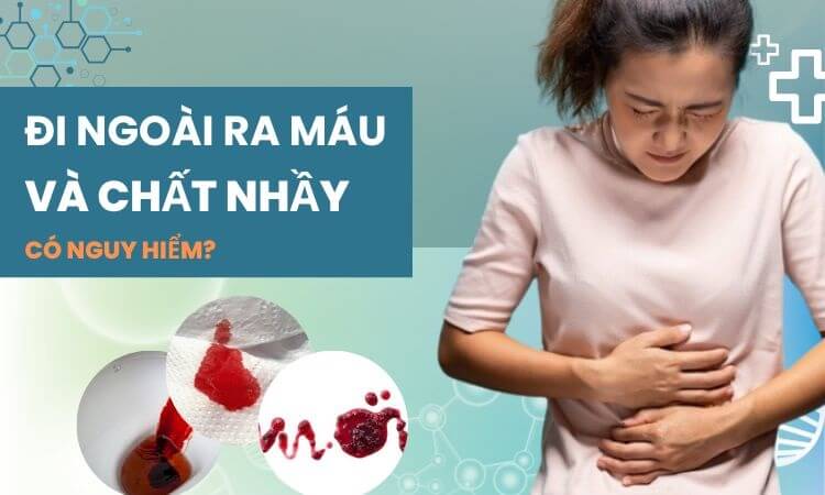 Đi ngoài ra máu và chất nhầy là dấu hiệu của bệnh gì?