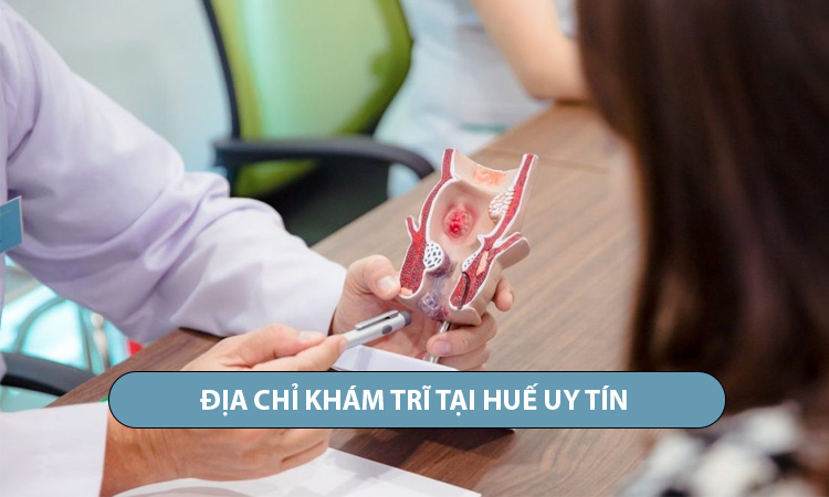 Top 5 địa chỉ khám trĩ ở Huế uy tín, an toàn và chất lượng