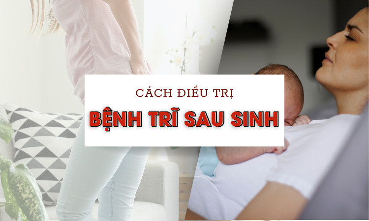 Bệnh trĩ sau sinh: Sau sinh bị trĩ phải làm sao? cách điều trị