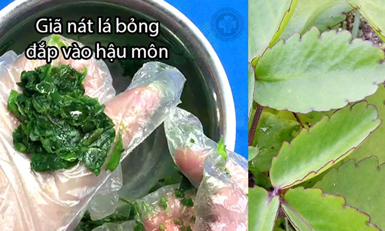 Cây lá bỏng chữa bệnh trĩ